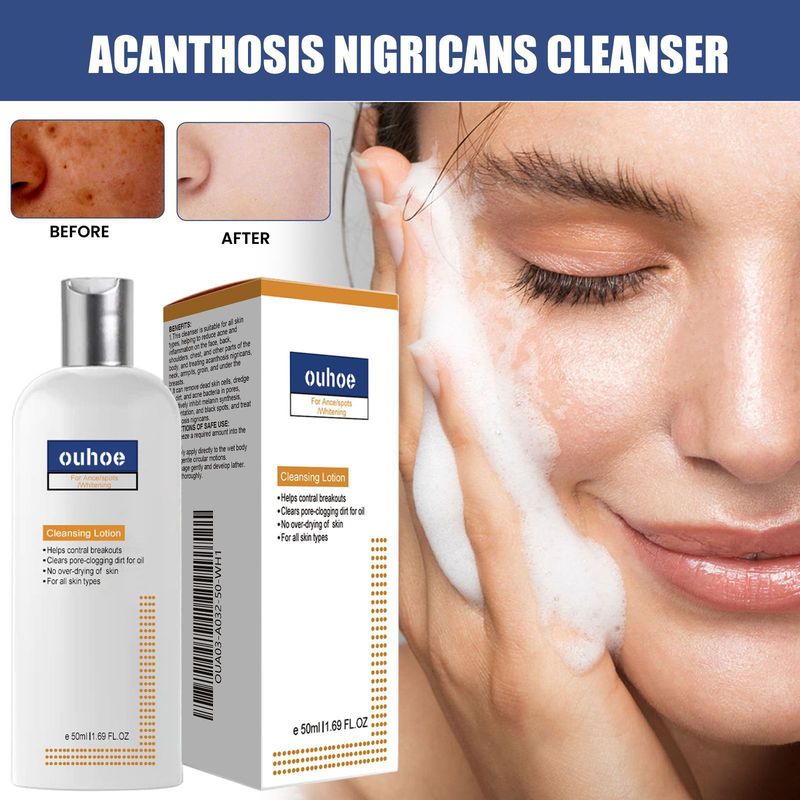 OUHOE Sort, tornet hudrens til dybderensning, blødgøring, reparation, oliekontrol og rensning af ansigtet_voghion.com