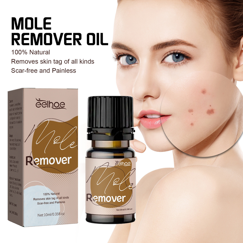 Eliminazione di nevi belli Riparazioni con olio di verruche, nevi neri, nevi convessi del viso Eliminazione di nevi, nevi che non lasciano segni_voghion.com