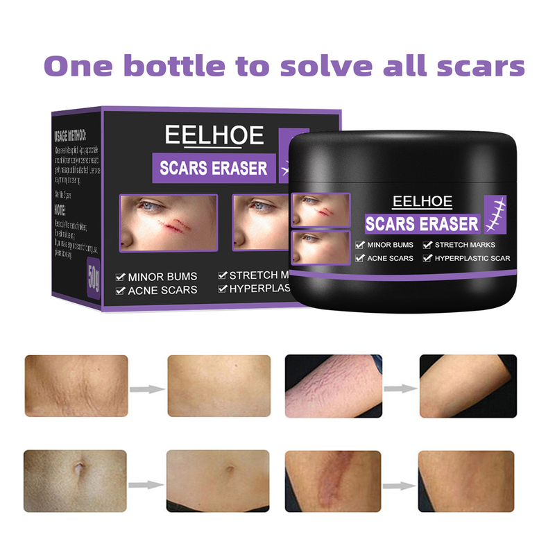 EELHOE Narbe zur Aufhellung postoperativer Narben, zur Glättung der Haut, zur Reparatur und Befeuchtung der Hautpflegecreme_voghion.com