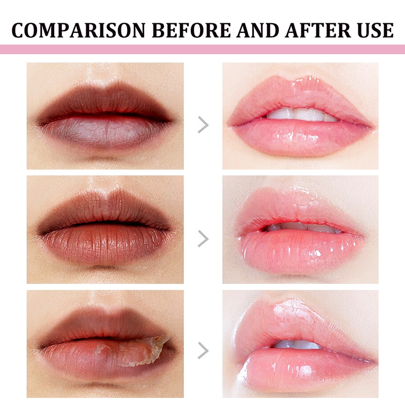 Der EELHOE Black Removing Lippenstift kann Lippenlinien aufhellen, abgestorbene Haut entfernen, ohne zu fetten, dunkle, zarte Lippen abschneiden und_voghion.com
