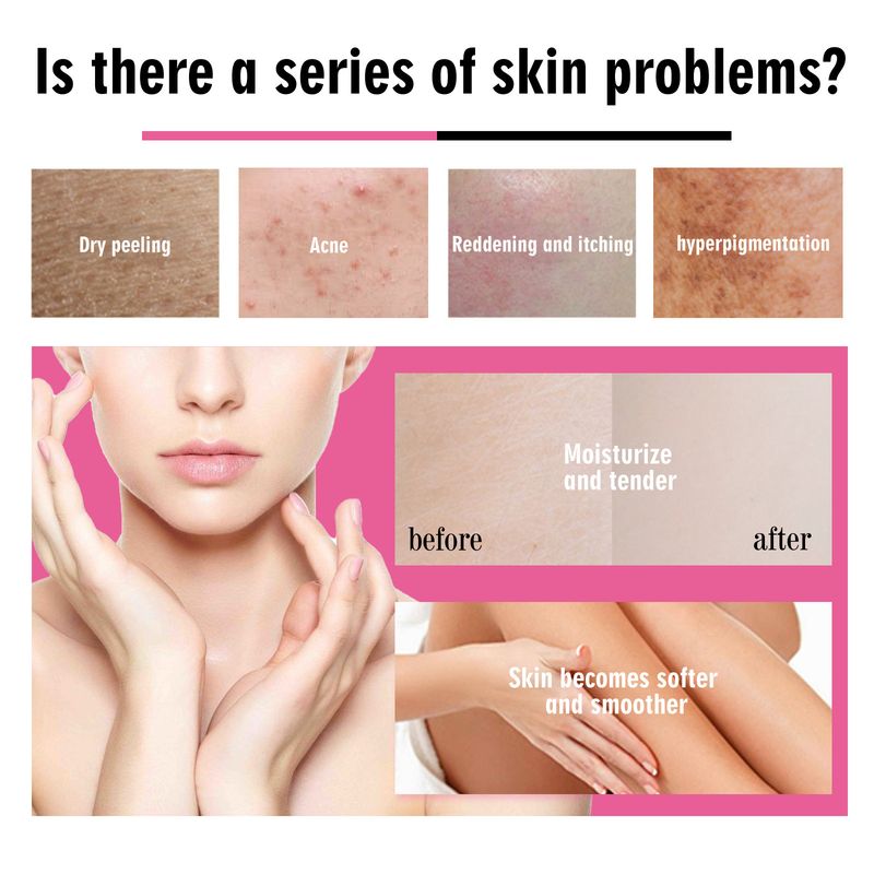 OUHOE Äerdbier Haut Weichmachend Massage Kierper Hautpfleeg Essentiellt Ueleg_voghion.com