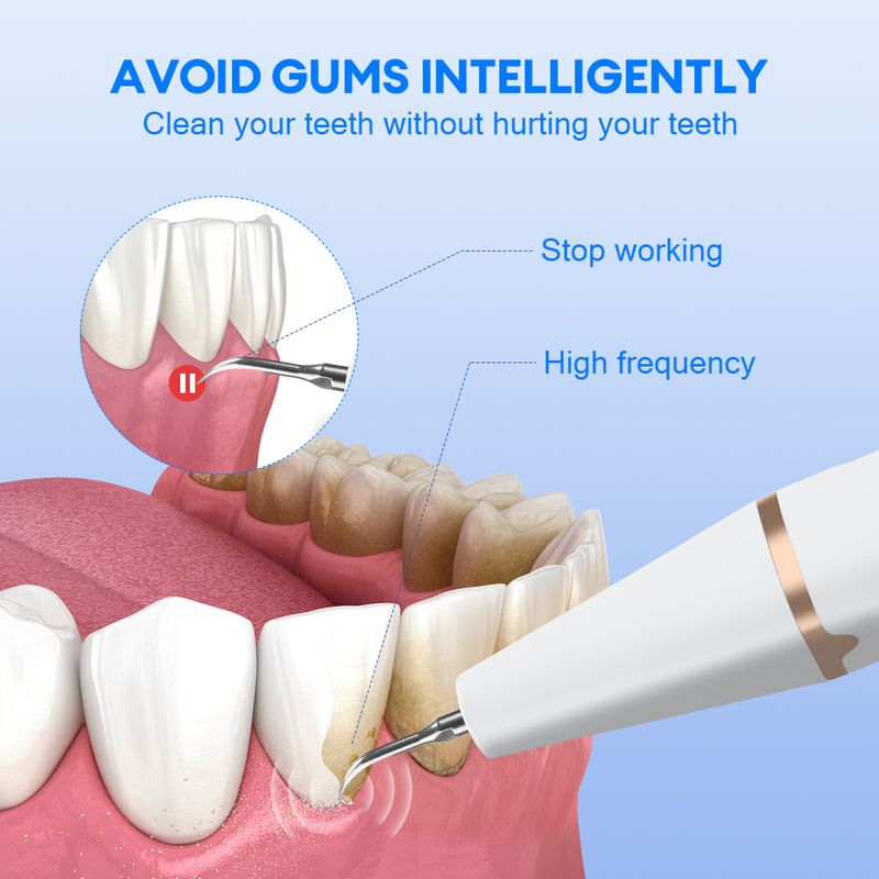 1 buc/2 buc/30ml dentar cu ultrasunete, îndepărtarea tartrului dinților, îndepărtarea plăcii scaler, eliminarea tartrului, curățarea petelor, electrică, îndepărtarea pietrei dentare_voghion.com