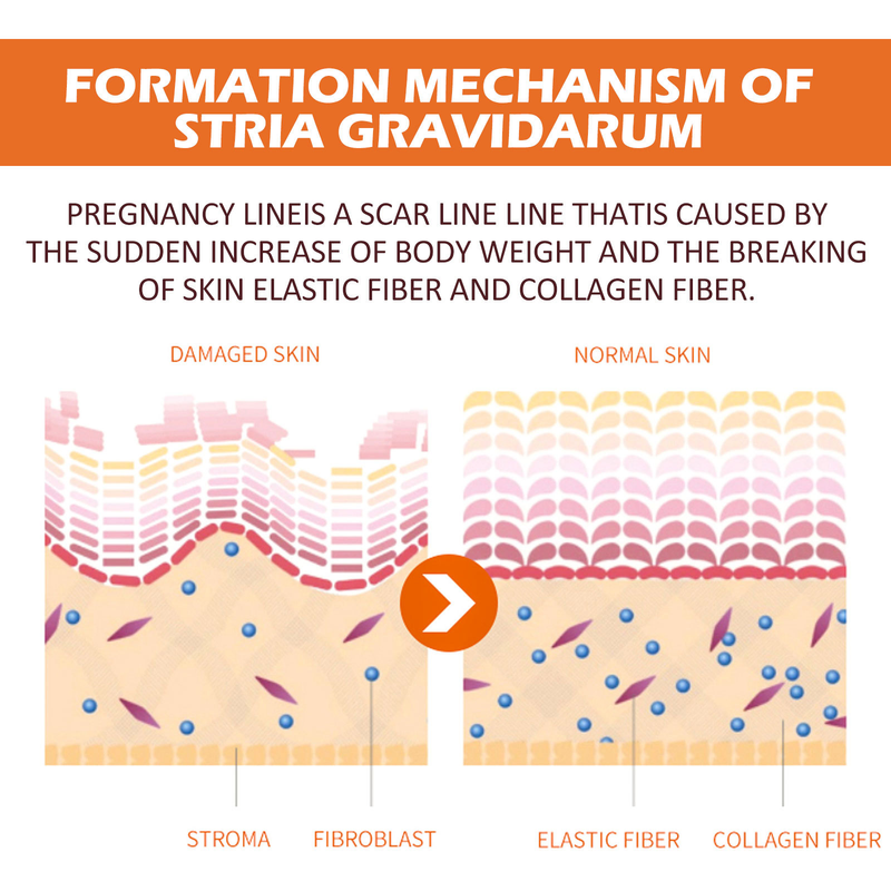 EELHOE Neuropeptid-Protein-Narbenlinderung, Schwangerschaft, Körperlinienpflege, Massagecreme für glatte Haut_voghion.com