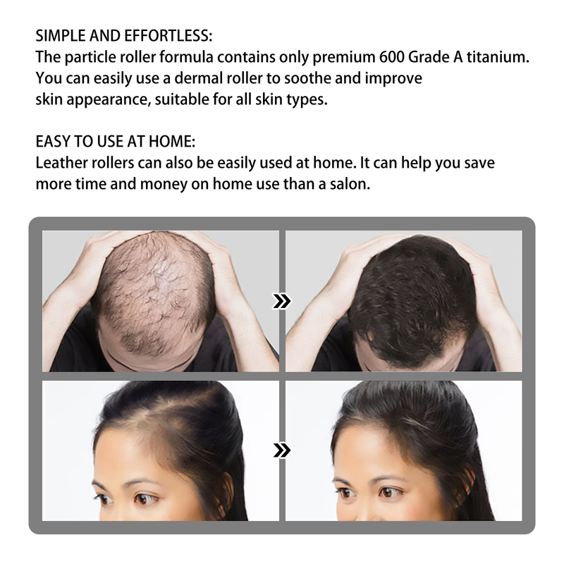 Jaysuing Scalp favorise l'épaississement du peigne à cheveux de massage à rouleaux_voghion.com