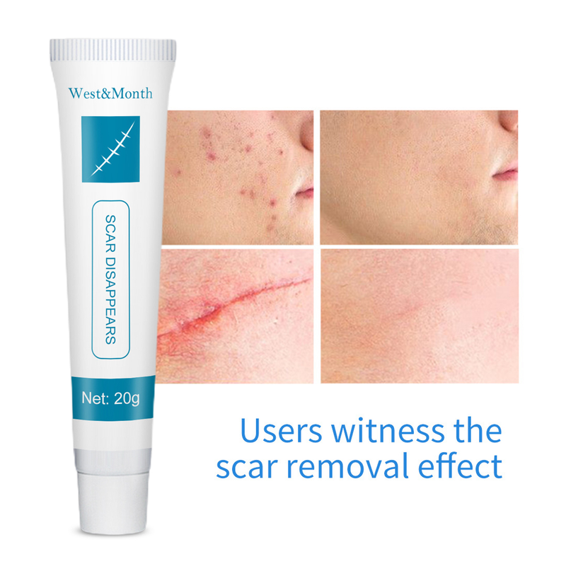 Gwong 20g Acne Mark ziede, efektīva, viegla, ērta pūtītes rētu noņemšanas ādas atjaunojošs krēms skaistumam_voghion.com