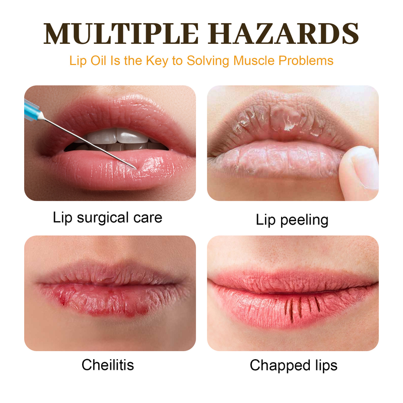 EELHOE Honig zum Aufhellen von Linien, zur Vorbeugung von Trockenheitsrissen, Hautpeeling, Lippen, Befeuchtung und Schutz des Lippenöls_voghion.com