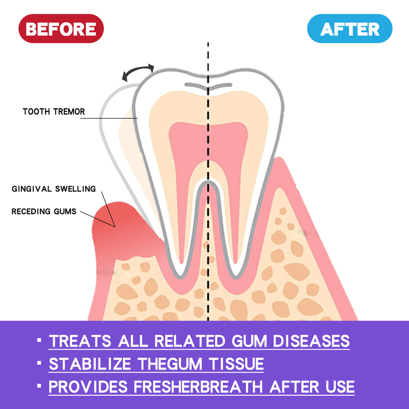 EELHOE foam Care Gum Deep Dirt Tooth Cleaning Mousse Toothpaste_voghion.com