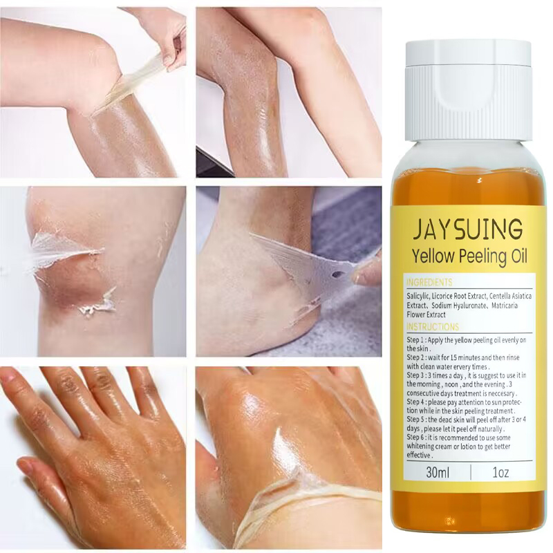 Giel Peeling Ueleg Däischter Haut Bleechung Ewechzehuelen Aarm Knéi Been Melanin Kierper Peeling Brightening Whitening Beauty S_voghion.com