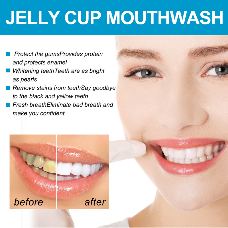 Jelly Cup beautiful Mouthwash Cleansing for Odor, Tooth Stains, Stains Stains, Brightening and Whitening of Teeth Care,_voghion.com