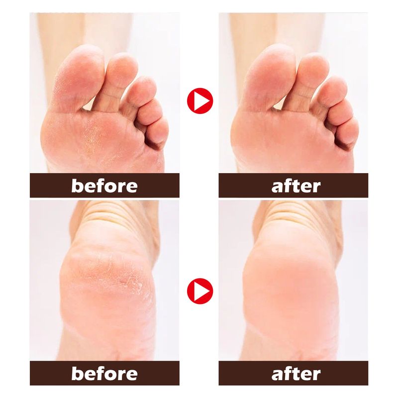 Uleiul de cal EELHOE repară pielea uscată și crăpată, exfoliază și hidratează pielea pentru picioare_voghion.com