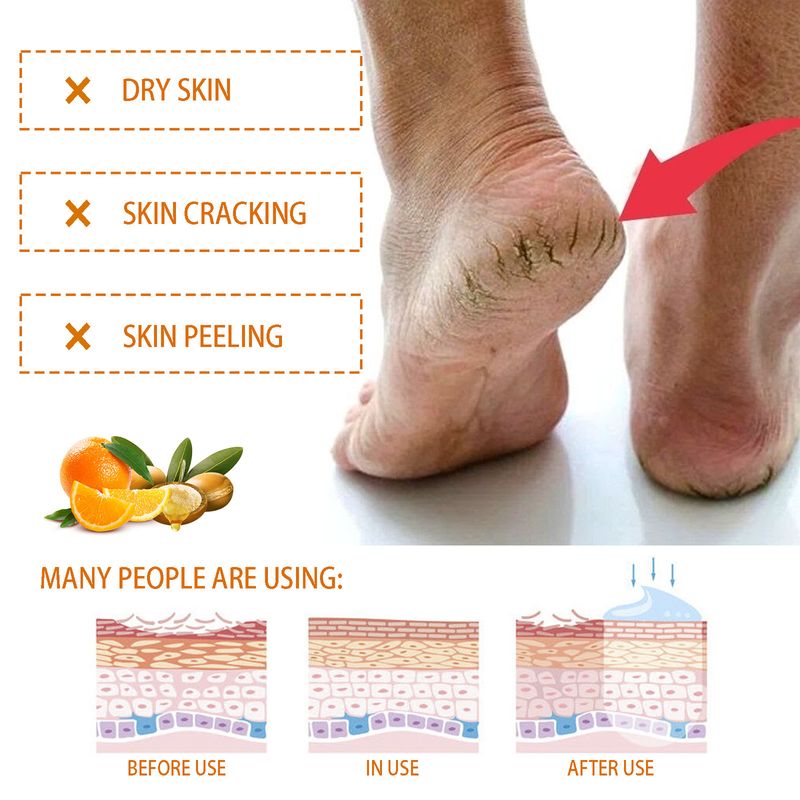 Hoygi Nourishing Hand Foot Care Cream verhënnert Rëssbildung vun den Hänn a Féiss, Reparatur vun doudegen Haut, Hydratatioun an Feuchtigkeit vun der dréchener Haut_voghion.com