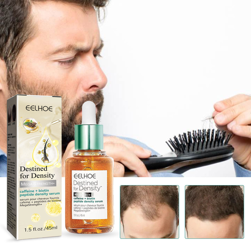 EELHOE Anti Moisturizing Thick hairline Esence pro pevné vlasy proti vypadávání_voghion.com
