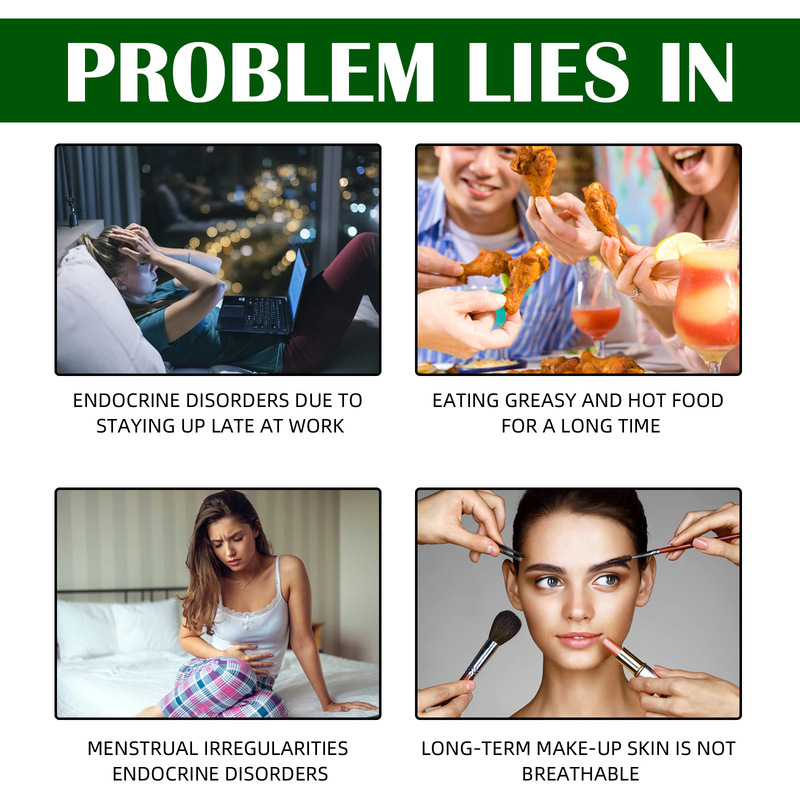 West&Month - Aceite esencial reparador de piel artificial absorbente líquido, maquillaje invisible, corrector resistente al agua, parche para el acné_voghion.com