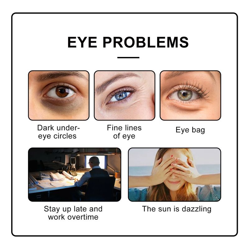 Roller Cream with Ball Massage to Fade Fine Lines Around the Eyes, Bags, Eye Swelling, and Black Circles_voghion.com