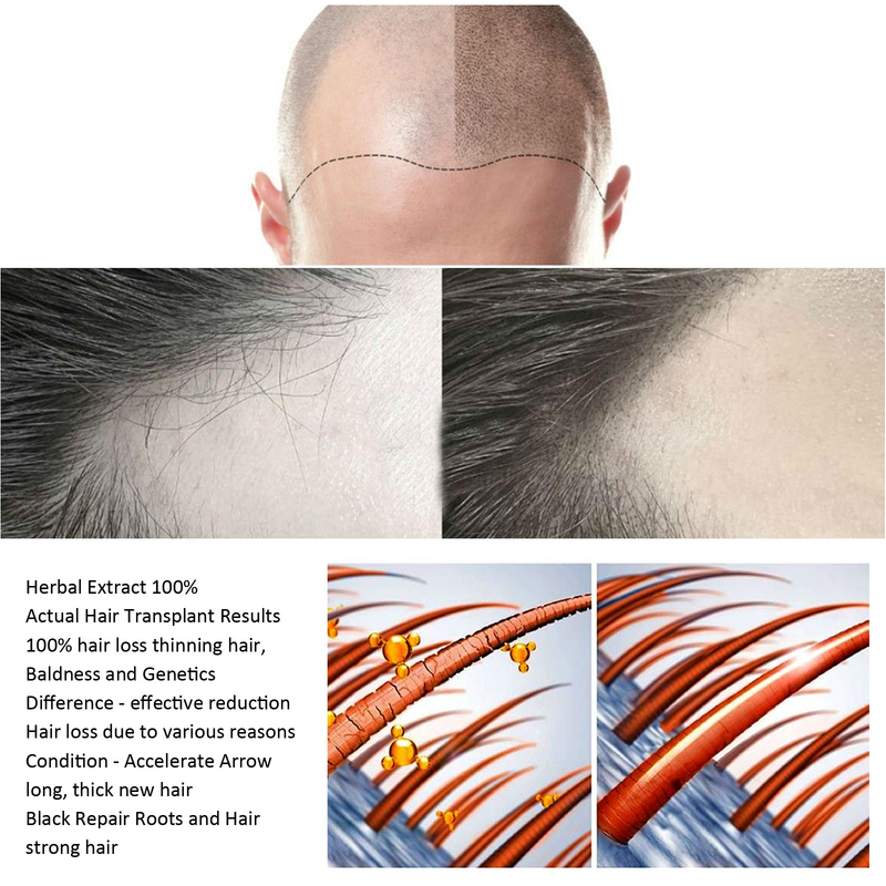 EELHOE un Tough Anti dropping Firm Care mitrinošs blīvs matu laks_voghion.com