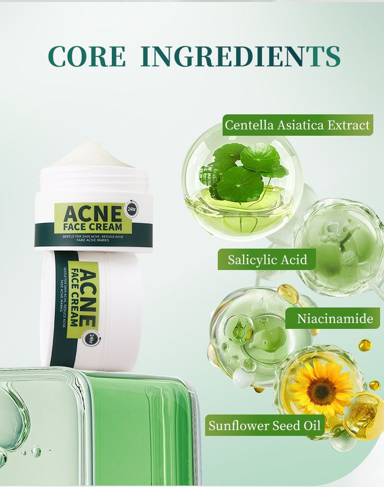 Treatments & Masks Anti Acne Facial Cream Moisturizing And Rejuvenating Acne Cream Facial Care_voghion.com