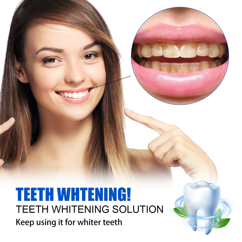 Whitening Jayswing Tand essentie Mondreiniging & Tand Reparatie & Vlekverwijderaar Tand Vergeling & Tandsteen Zorg Reiniging &_voghion.com