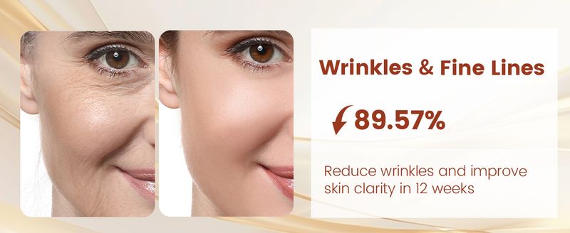 Red Light Therapy For Face, Infrared LED Face Mask Light Therapy 4 Light Waves With 850nm Near Infrared, Portable Rechargeable_voghion.com