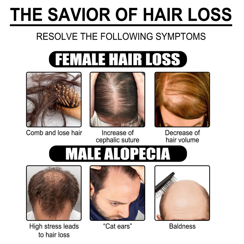 EELHOE Ginger Essential for Repairing Follicles, Smooth Moisturizing Growth, and Nourishing Hair Care Essence Oil_voghion.com