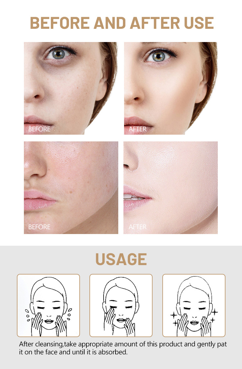 Rice Toner Moisturizes, Brightens, Replenishes Water And Nourishes Sensitive Skin_voghion.com