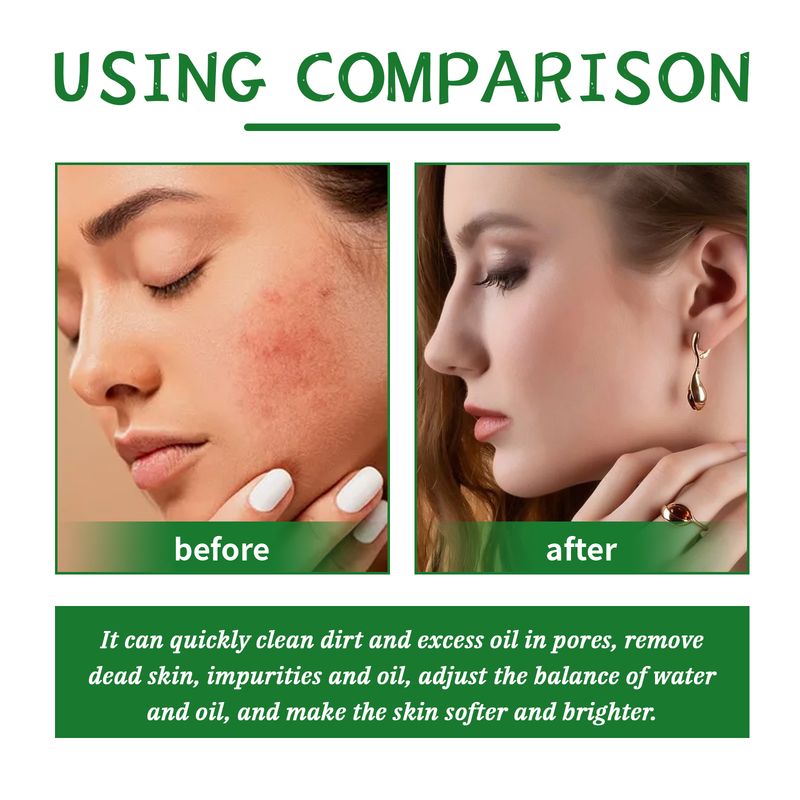 EELHOE Aloe Vera Scrub For Deep Cleansing, Exfoliating And Smoothing Acne Marks, Soft Skin Scrub_voghion.com