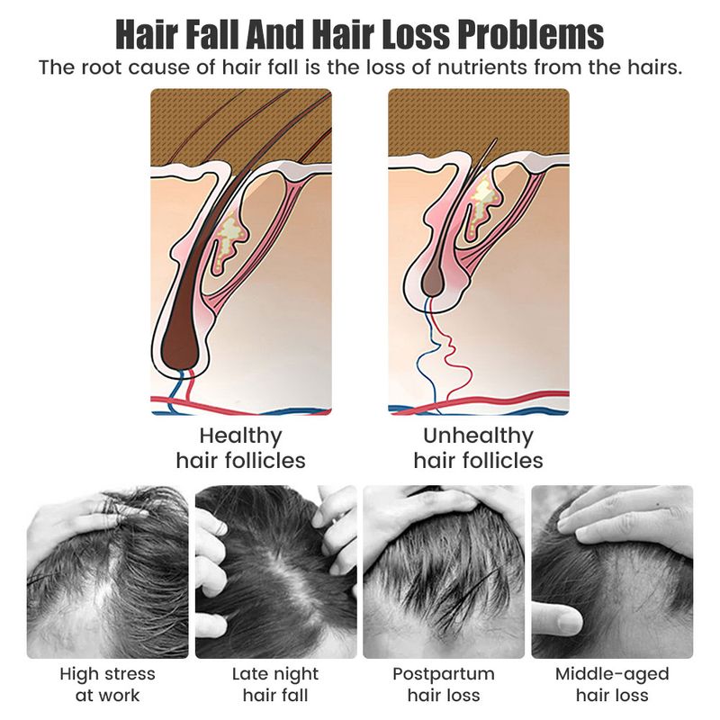 Matu augšanas ķemme RF sarkanā zilā gaismā elektriskā lāzera pret matu izkrišanas procedūra EMS vibrācijas galvas ādas masāžas matu suka relaksējoša galvas āda_voghion.com