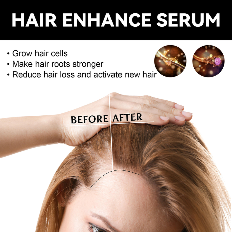 OUHOE Dense idrata le radici, ripara i capelli, ripara l'olio essenziale per la cura dei capelli danneggiati, secchi e furiosi_voghion.com