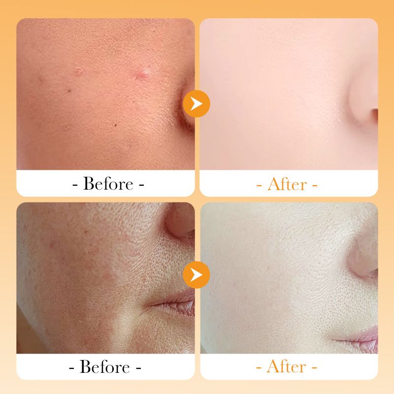All English SADOER Vitamin C Whitening&Whitening Moisturizing&Toner spray_voghion.com