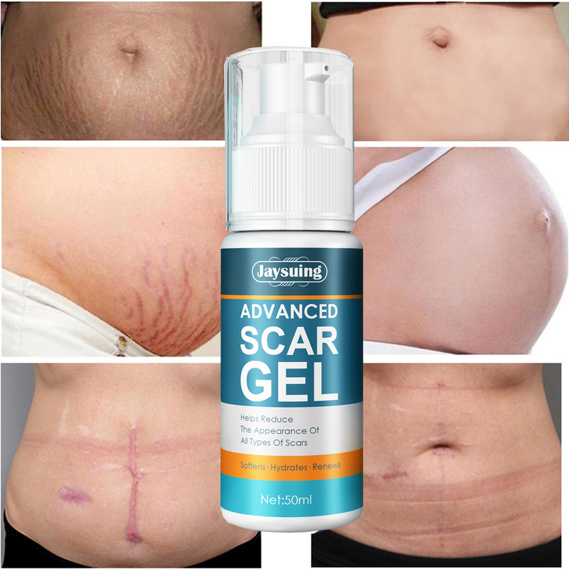 QLZHANFU Crème avancée d'élimination des cicatrices Boutons d'acné Réparation des vergetures Gel Brûlure Traitement chirurgical des cicatrices Lissage Beauté du corps Soins de la peau_voghion.com