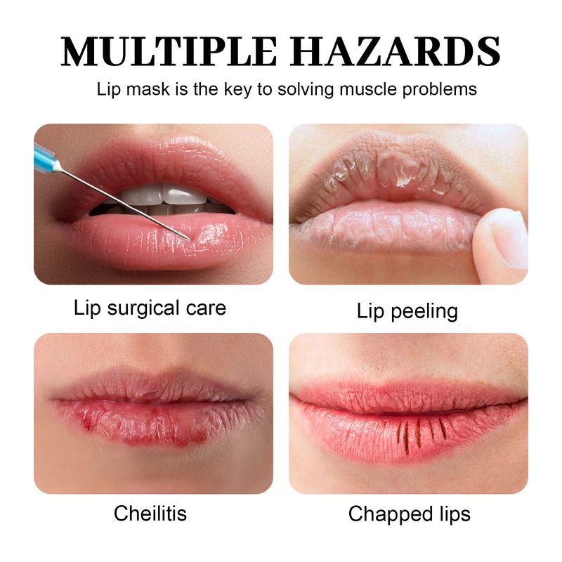 Moisturizing Mask To Lighten Lip Lines, Remove Dead Skin, Prevent Dry Cracks, Moisturize, Smooth, And Plump Lips Care_voghion.com