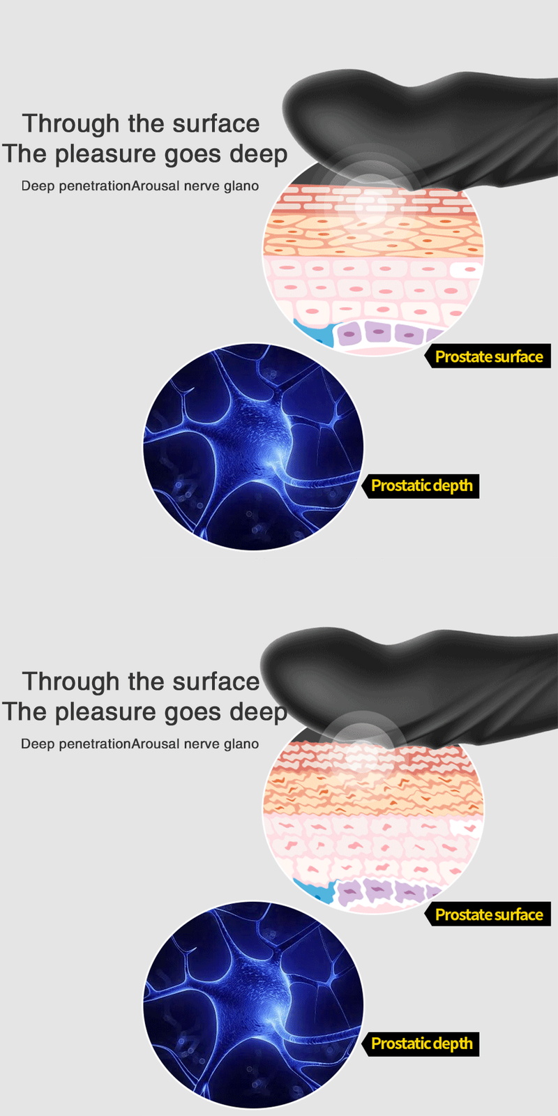 Dildo Remote Control Vibr Dual Vibrating Swing Butt Plug Male Prostate Massager Anus Dil Metal Beads Rotat      ating_voghion.com