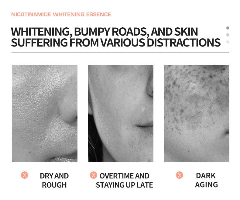 Cross Border Niacinamide Brightening Essence Vloeibare Hydraterende, Verhelderende en Anti-Rimpel Essence_voghion.com
