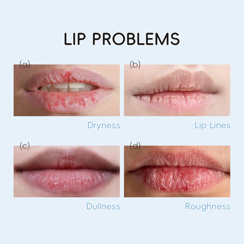 Máscara labial e para os olhos Laikou, 8 conjuntos de 5 peças, máscara hidratante para os lábios e para os olhos_voghion.com