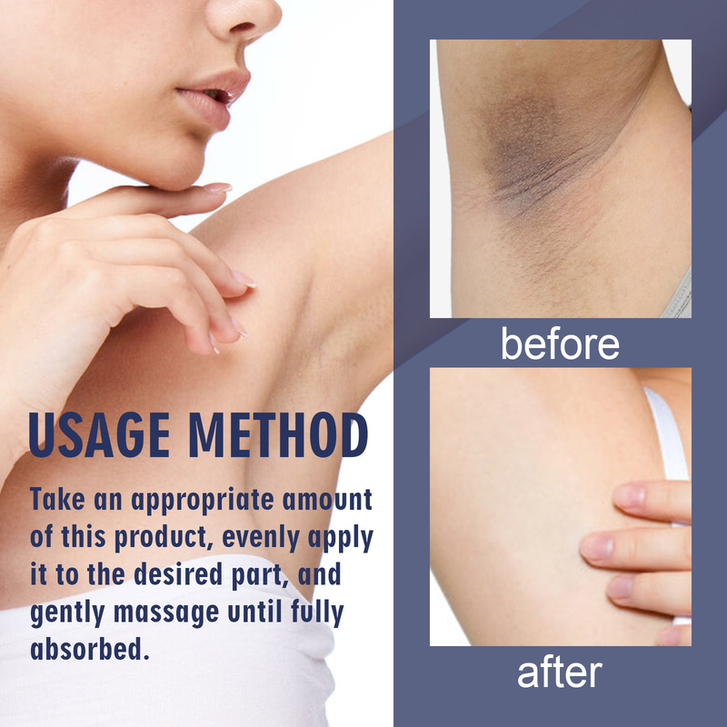 OUHOE Repairs Knee, Finger Joint, Elbow, and Underarm Melanin Moisturizing Skin Whitening Cream_voghion.com