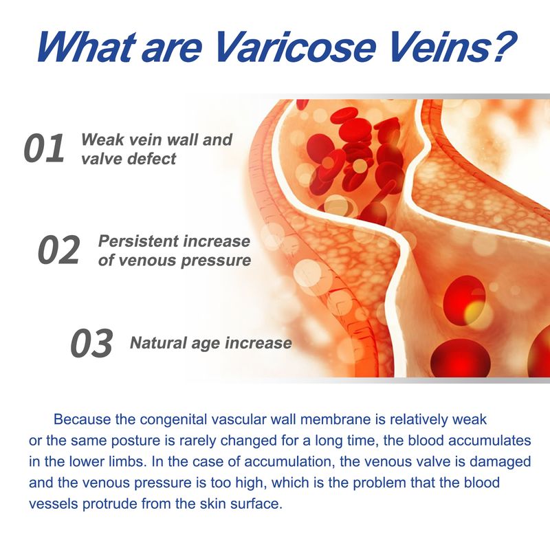 South Moon lábápoló krém enyhíti a lábfájdalmat, kényezteti és hidratálja a bőrt, napi masszázskezeléssel_voghion.com