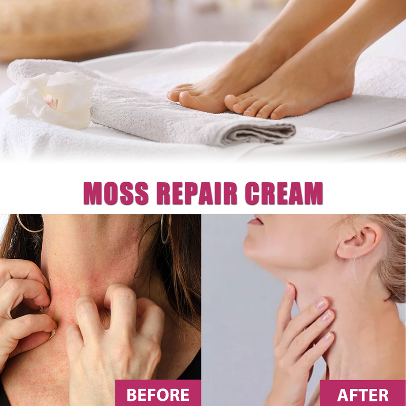 EELHOE Hand and Foot Moisturizing Repair Cream relieves itching, relieves itching, repairs dandruff, moisturizes and moisturizes the skin_voghion.com
