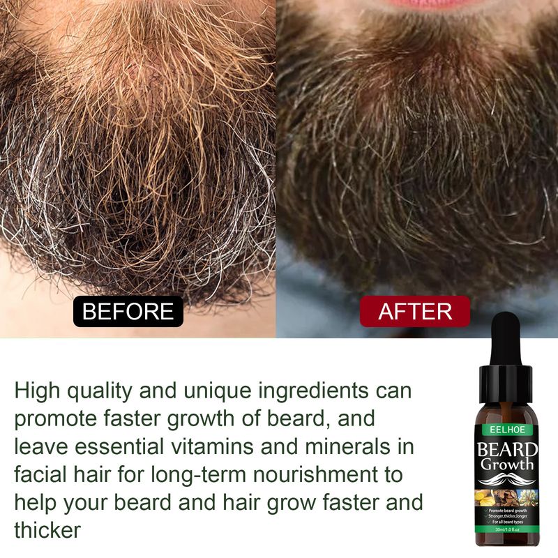 EELHOE Facial Hair Care Oil Nourishing Moisturizing Spray Facial Hair Care Fluffy And Soft Nourishing Oil_voghion.com