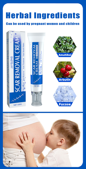 5-dnevna obnovitvena krema za brazgotine Hitro odstranjevanje kožnih brazgotin Zdravljenje kirurških brazgotin Strije Odtisi aken Pox Gel za nego obraza Popravilo opeklin_voghion.com
