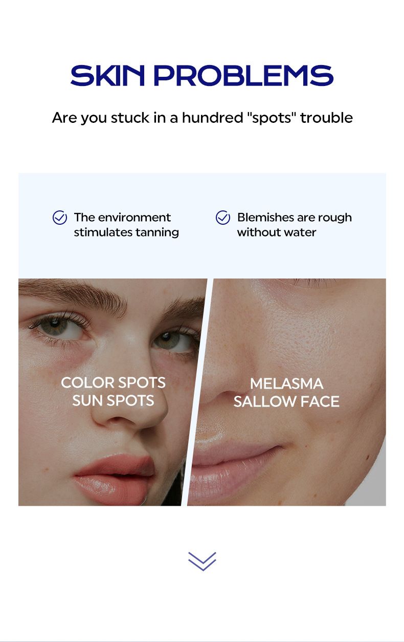 Spot-Reducing Whitening Cream Moisturizing And Nourishing Face Cream For Dry Skin 100g_voghion.com