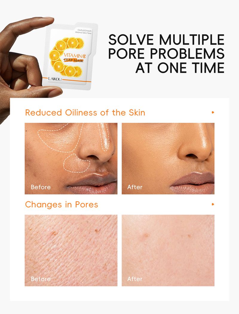 Trattamenti e maschere Spot Nuovo prodotto LAIKOU Maschera di fango alla vitamina C 5 g*12 Deterge i pori e idrata_voghion.com