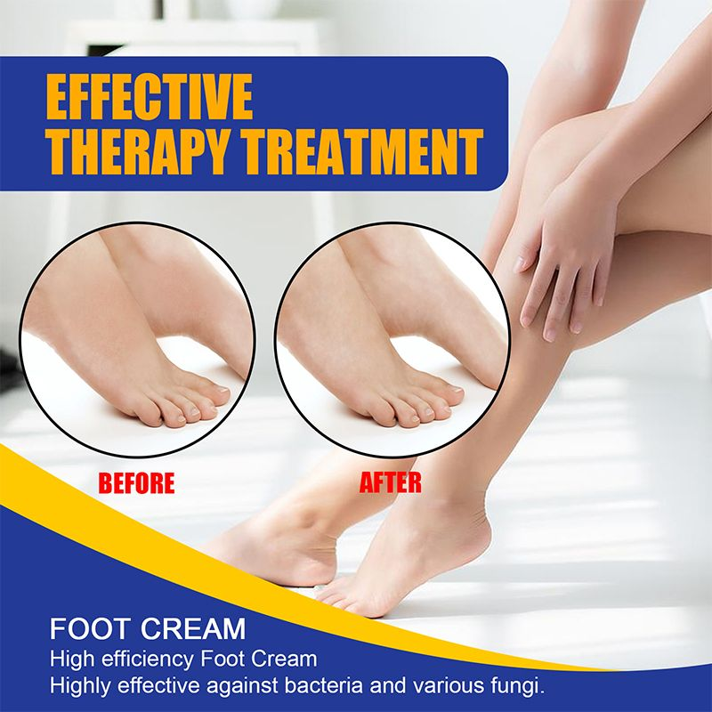 Crème de thérapie de pédicure nourrissant et protégeant les pieds, éliminant les puanteurs, les démangeaisons, les fissures des pieds,_voghion.com