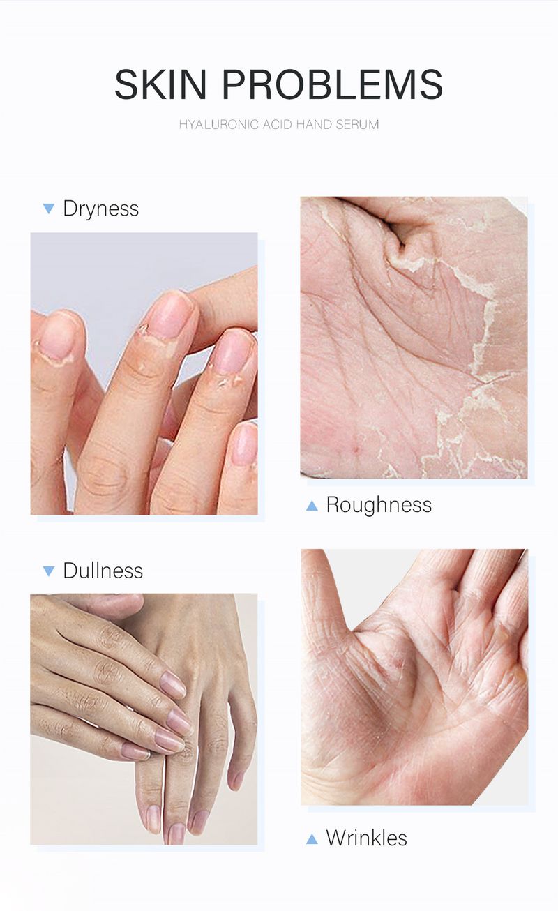Scrubs & Bodys Treatments Hyaluronzuur Handcrème 50ml Hydraterend Engelse verpakking_voghion.com