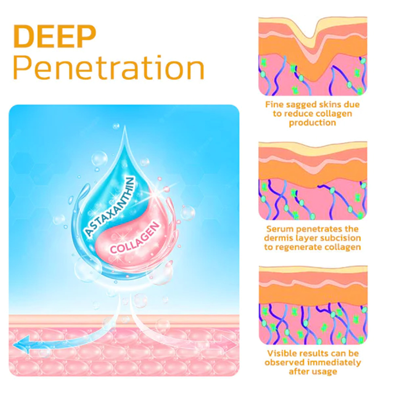 Acido della frutta Hoygi per indebolire le linee sottili, sollevare la pelle del viso, rassodare, idratare e resistere all'essenza delle rughe_voghion.com