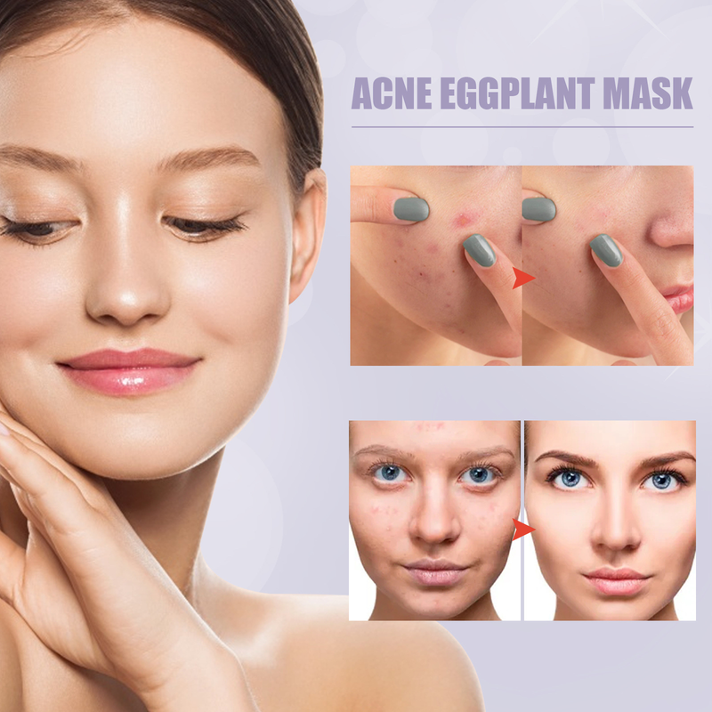 EELHOE Gréngen Téi Solid Oil Control Cleaning Akne Replenishing Moisturizing Gesiichtsmaske Stick_voghion.com