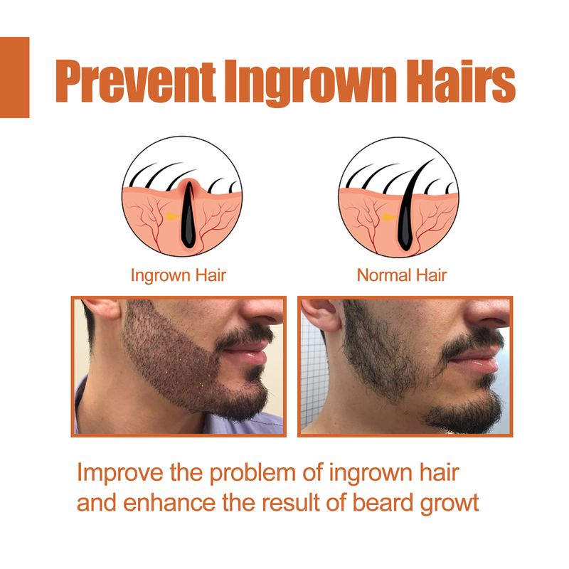 Powerful Beard Growth Oil for Faster and Thicker Hair Growth, Nourishing and Moisturizing Formula for Men_voghion.com