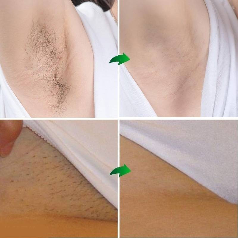 Nyaste professionell hårborttagningskräm för kvinnor/män Ben hårborttagningskräm Kraftfull permanent hårborttagningskräm Stoppa hårväxthämmare borttagning_voghion.com