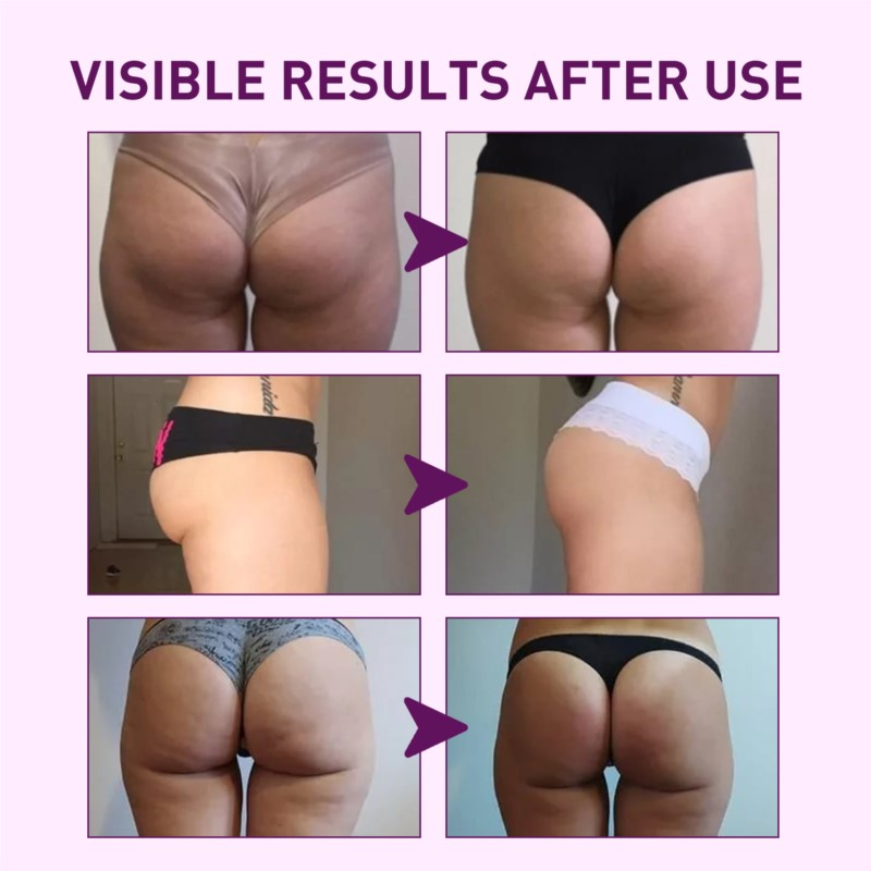 HIP-LIFT balsam do pośladków poprawia relaks ujędrniający krem na pośladki i organiczny szybko wchłaniający się krem powiększający biodra duże pośladki_voghion.com