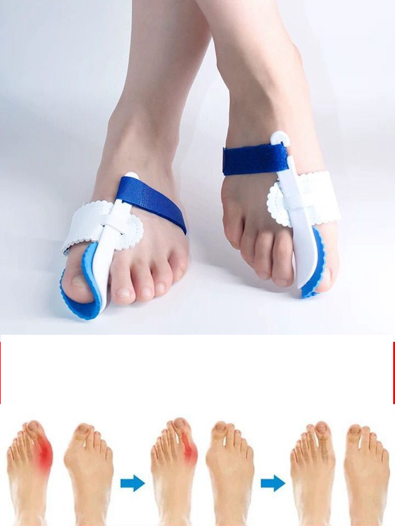 Hallux Valgus-Korrektur für den großen Zeh, Hallux-Valgus-Korrektur, Inversion des großen Zehs, geteilter Zeh, Männer und Frauen, blaue Kunststoffhalterung_voghion.com