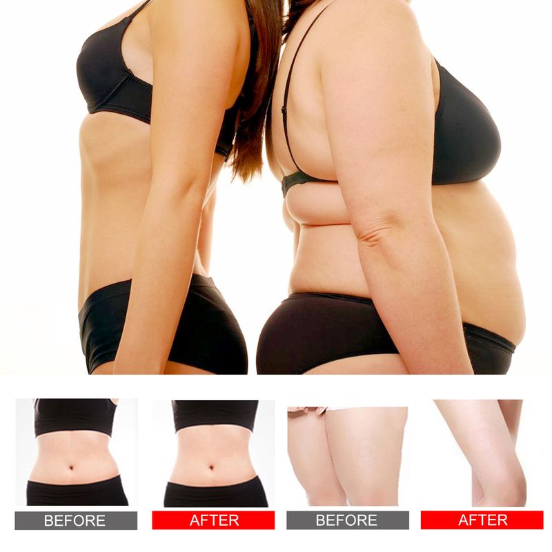 South Moon Ginger Health Strakke en afslankende dikke buik, dijen, smalle taille, lichtgewicht body shaping patch_voghion.com