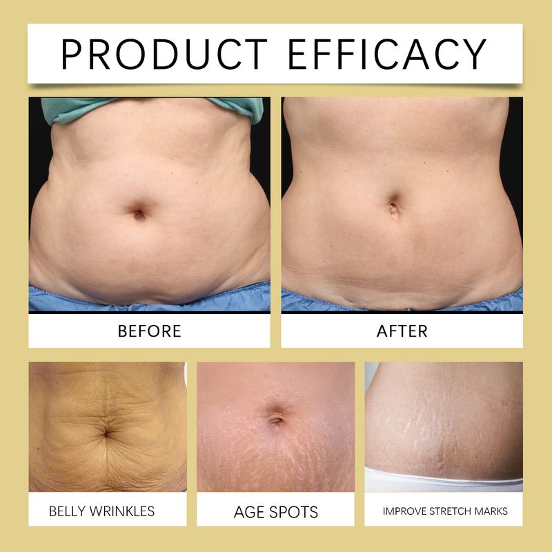 Körperpflegeöl Körperstraffungsmassage Feuchtigkeitsspendende Tagespflege Haut Körperpflegeöl_voghion.com